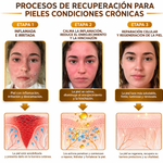 BEE VENOM - CREMA PARA LA PIEL CON VENENO DE ABEJA PARA LAS MANCHAS Y VERRUGAS