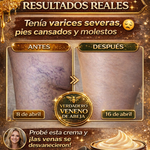 BEE VENOM - CREMA PARA LA PIEL CON VENENO DE ABEJA PARA LAS MANCHAS Y VERRUGAS