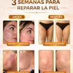 BEE VENOM - CREMA PARA LA PIEL CON VENENO DE ABEJA PARA LAS MANCHAS Y VERRUGAS