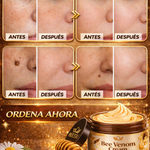 BEE VENOM - CREMA PARA LA PIEL CON VENENO DE ABEJA PARA LAS MANCHAS Y VERRUGAS